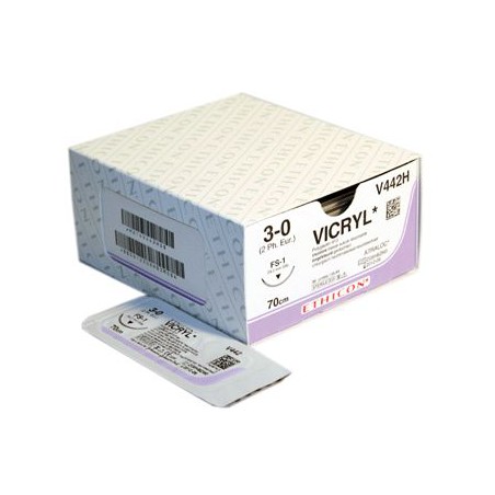 V397H SUTURE IN VICRYL